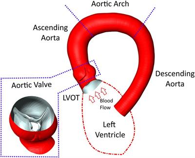 Modelling blood flow in patients with heart valve disease using deep learning: A computationally efficient method to expand diagnostic capabilities in clinical routine